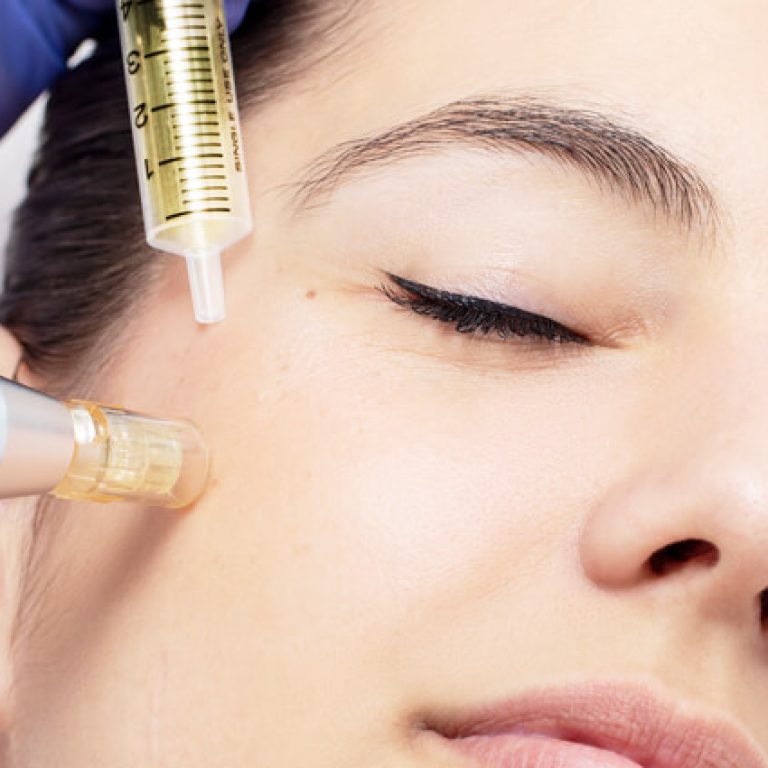 Face-Mesotherapy